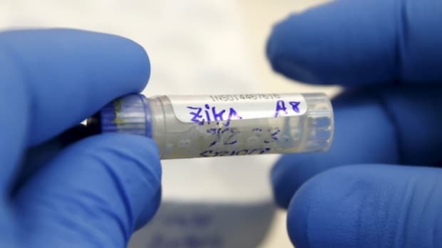 AQShda Zika virusiga chalingan go‘dak vafot etdi
