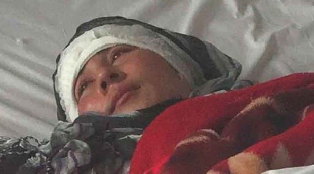 Erkak rashk sababli rafiqasining ikki qulog‘ini kesib tashladi