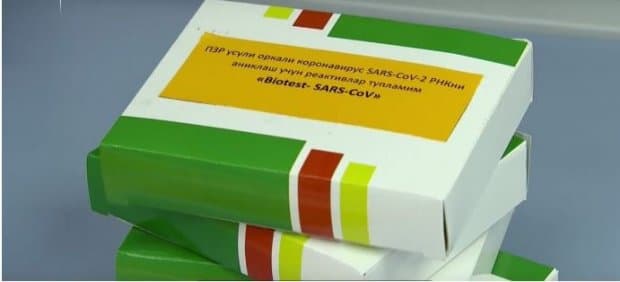 Олимларимиз ишлаб чиққан тест тизими коронавирусга чалинган беморларда синовдан ўтказилмоқда