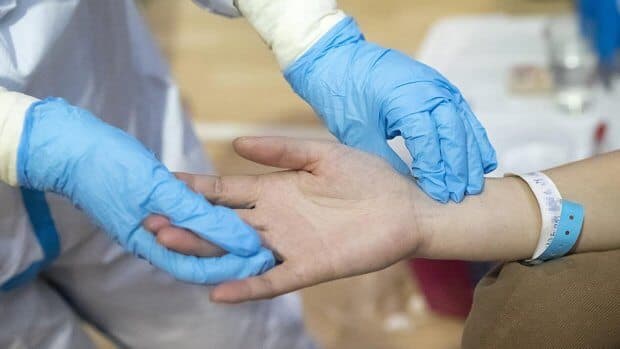 Франциялик шифокорлар коронавируснинг янги белгиларини маълум қилди