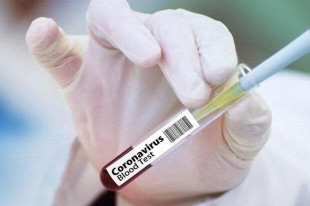 Қозоғистонда коронавирус юқтирганлар сони 961 нафарга етди