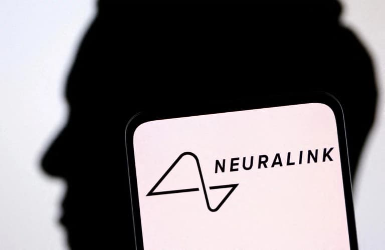 Miyasiga Neuralink chipi o‘rnatilgan birinchi odam fikr kuchi bilan tvit yozdi