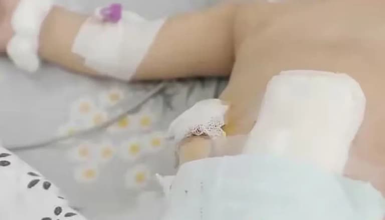 Taşkent'te fast food ile beslenen bebek bağırsak çürümesine yakalandı, ciddi bir ameliyat geçirdi