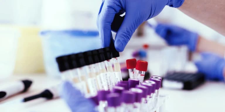 Why is TORCH testing important before pregnancy?