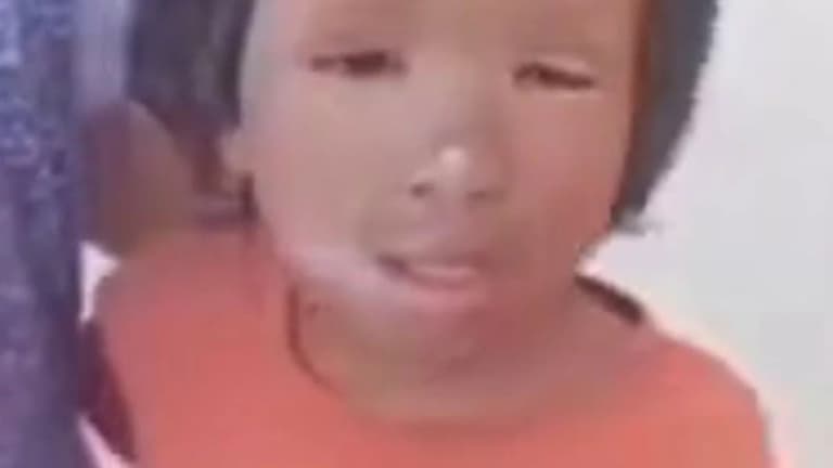 Girl suffers facial injuries after being electrocuted after following cat tracks