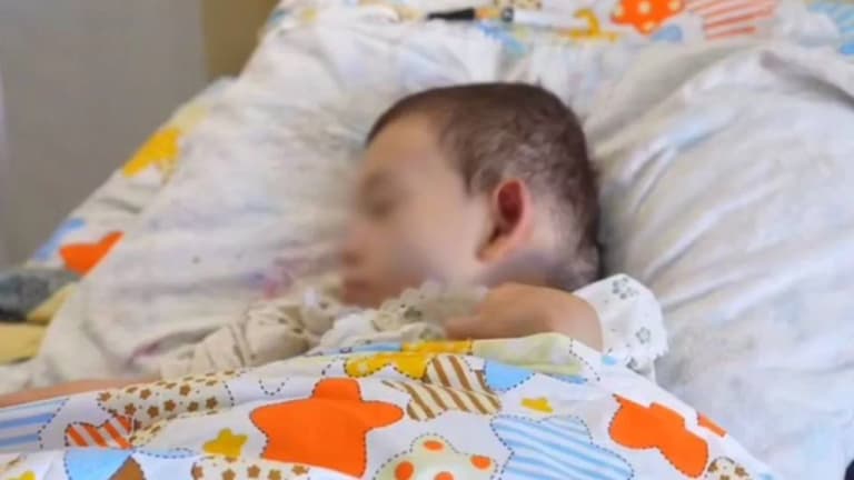 Өзбекстанда 7 жасар қыздың миына күрделі операция жасалды