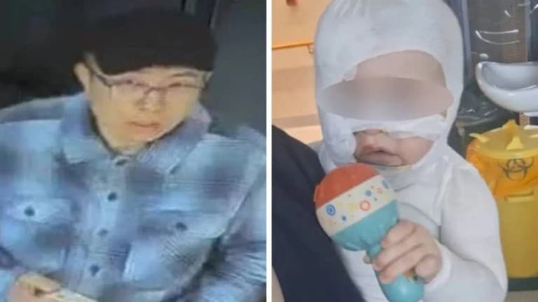 Chaqaloqqa qaynoq qahva sepgan erkak  ishi keskinlashdi