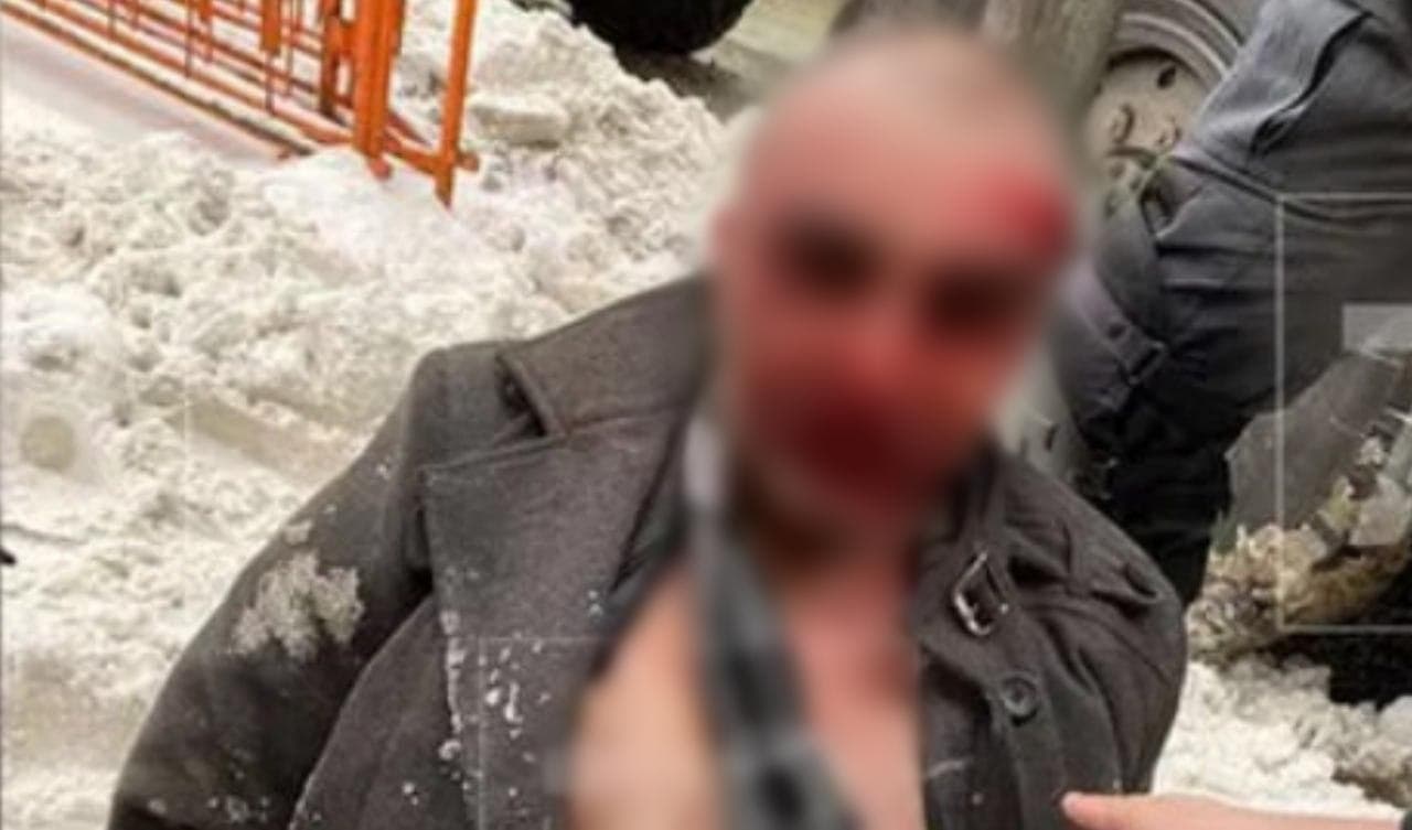 Rossiyada OMON xodimiga o‘q uzgan o‘zbekistonlik erkak aslida maqsadi nima bo‘lganini aytdi