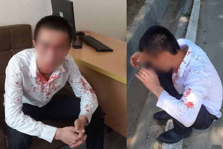 Toshkentda o‘qituvchi kaltaklangani yuzasidan jinoyat ishi qo‘zg‘atildi