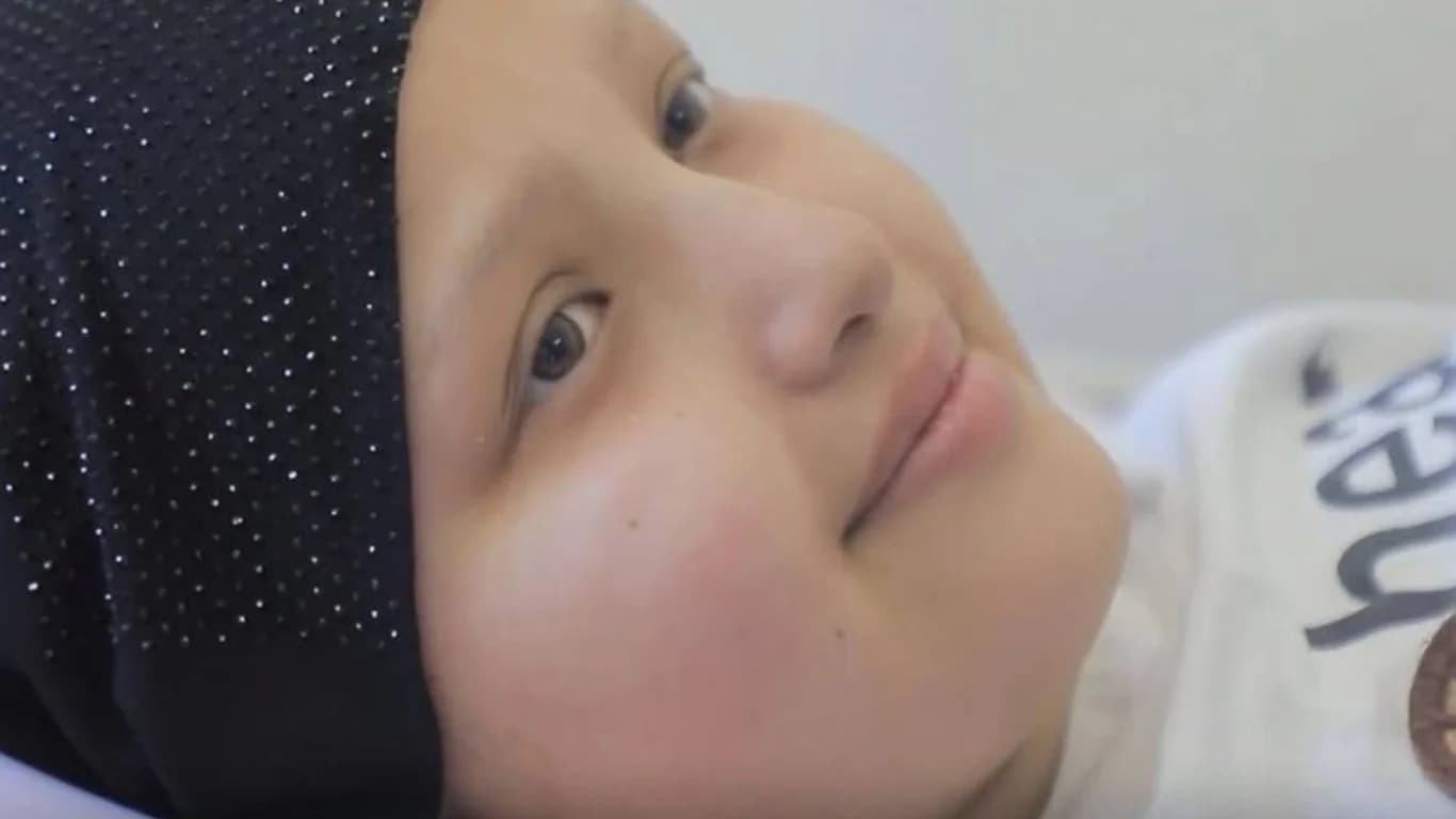 В преддверии Курбан хайита 15-летней девочке провели бесплатную операцию