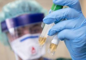 Toshkent shahrida aholi orasidan yana 7 kishida koronavirus aniqlandi фото