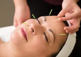 Фото: Pinterest Акупунктура – тиббиётда игна билан даволаш