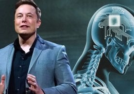 Илон Маскга тегишли Neuralink компанияси инсон онгидаги
