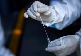 Коронавирусга чалинганда Covid-19`га хос бўлмаган симптомлар ҳам кузатилиши мумкинми? фото