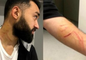 Futbolchi maydonga lezviya olib kelib, raqiblarini yaraladi фото