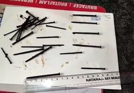 Ҳиндистонда бир эркак 116 та катта михни ютиб юбориб, бу