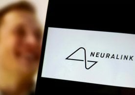 Илон Маскнинг Neuralink чипи учинчи беморга ўрнатилди фото