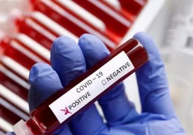 2022 йил 9 январь ҳолатига кўра, Ўзбекистонда коронавирус