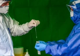 Россиялик олимлар коронавируснинг илк белгилари пайдо
