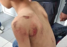 Фото: Бишкек ИИББ матбуот хизмати Бишкекда 33 ёшли эркак 9