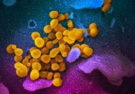 Elektron mikroskop vositasida olingan ushbu suratdagi