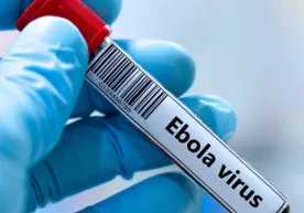 Kongo Demokratik Respublikasida Ebola virusi bilan