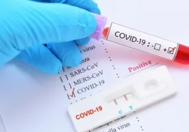 Ўзбекистонда 11 июль куни 458 кишида коронавирус