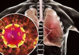 Koronavirus: qaysi viloyatlarda infeksiya ko‘p tarqalgani ma’lum bo‘ldi фото