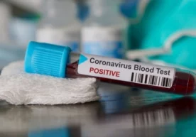 Farg‘onada bemor koronavirus yuqtirdim deb vahima ko‘tardi фото
