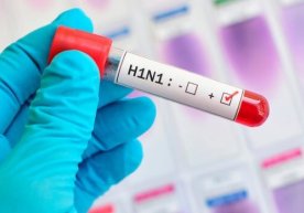 Koronavirus o‘lim holati bo‘yicha cho‘chqa grippidan o‘n barobar xavfliroq — JSST фото