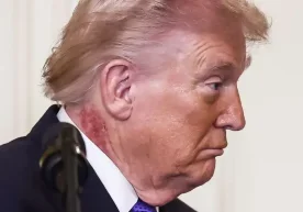 АҚШ президенти Доналд Трампнинг ташқи кўринишидаги мазкур