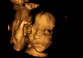 Homila operatsiya tufayli ona qornidan olinib, yana joyiga qaytarib qo‘yildi фото