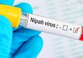 Аввалроқ Ҳиндистоннинг Калькутта шаҳри яқинида вакцина ва