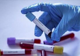 Yana 14 kishida koronavirus aniqlandi. Kasalga chalinganlar soni 534 nafarga yetdi фото