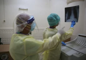 Foto: Global Look Press Koronavirus butun inson organizmi