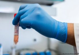 Koronavirus qanday haroratda o‘lishi haqida tadqiqot o‘tkazildi фото
