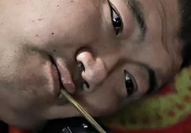 Хитойлик Юань Лидонь туғма ногиронлик билан дунёга келган