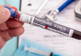 Эфиопияда биринчи марта Marburg вируси тарқалиши