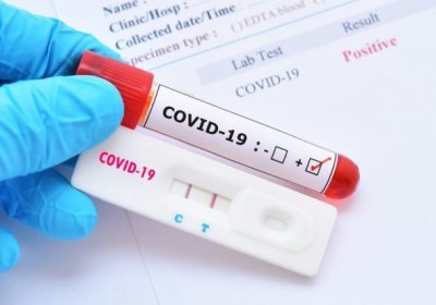 Академик прогнози: кузда коронавирус  пандемияси қандай кечади? фото