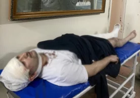 Miraziz Bozorovning kaltaklanishi yuzasidan rasmiy ma’lumot berildi фото