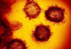 Fransiyalik olimlar "Tojdor virus" qanday haroratda nobud bo‘lishini aniqladi фото