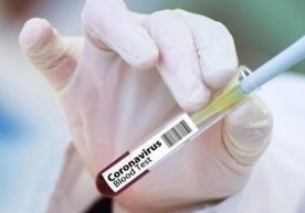 Қозоғистонда коронавирусга чалинган яна 10 та ҳолат қайд