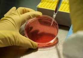 Жаҳон соғлиқни сақлаш ташкилоти (JSST) огоҳлантиришича,