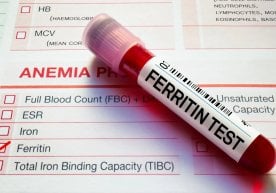 Ferritin ist eines der Hauptproteine, das Eisen im Körper