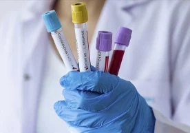 O‘zbekistonda 14 yanvar kuni 870 kishida koronavirus qayd