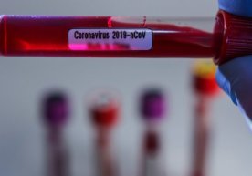 Koronavirus terrorizmga tenglashtirildimi? фото
