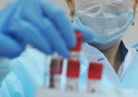 Rossiyadan koronavirus yuqtirib kelgan uch kishi tuzaldi фото