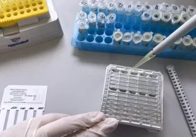 Беларусь фанлар академияси олимлари қон таҳлили орқали