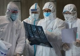 Foto: Reuters SARS-CoV-2 koronavirusining yuqori