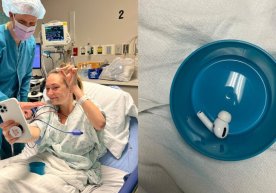 Америкалик аёл тасодифан AirPods Pro’ни ютиб юборди фото